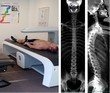 iDXA Total Body Scan